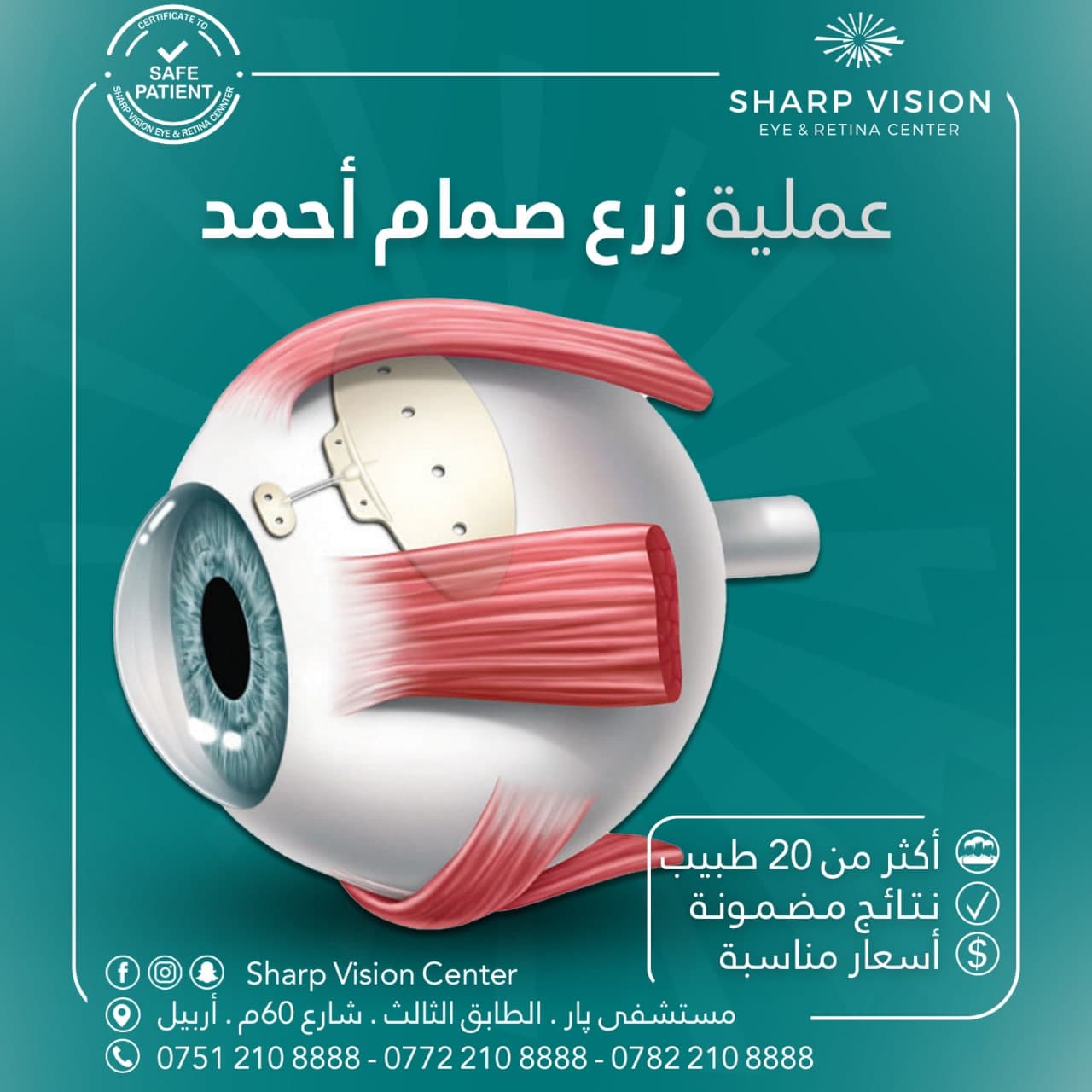 Sharp Vision